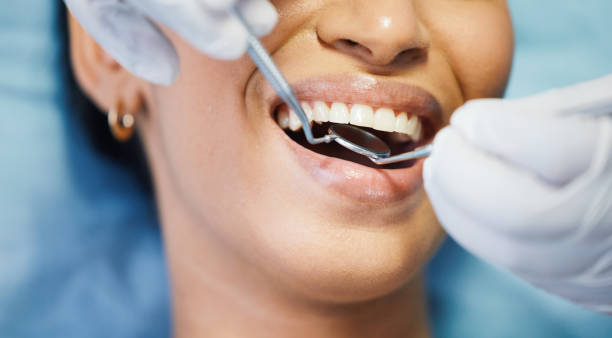 Dentist for Dental Trauma in FL